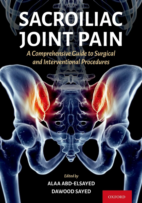 Sacroiliac Joint Pain Guide - Oxford University Press Book