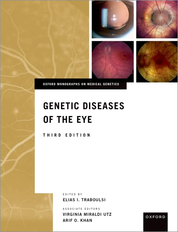 Genetic Diseases of the Eye (Oxford Monographs on Medical Genetics)