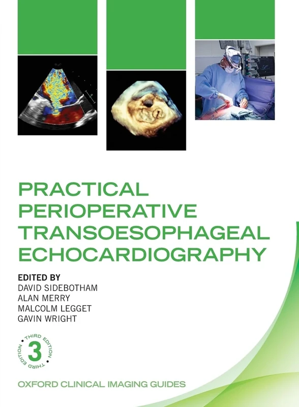 Practical Perioperative Transoesophageal Echocardiography (Oxford Clinical Imaging Guides): OCIG:P