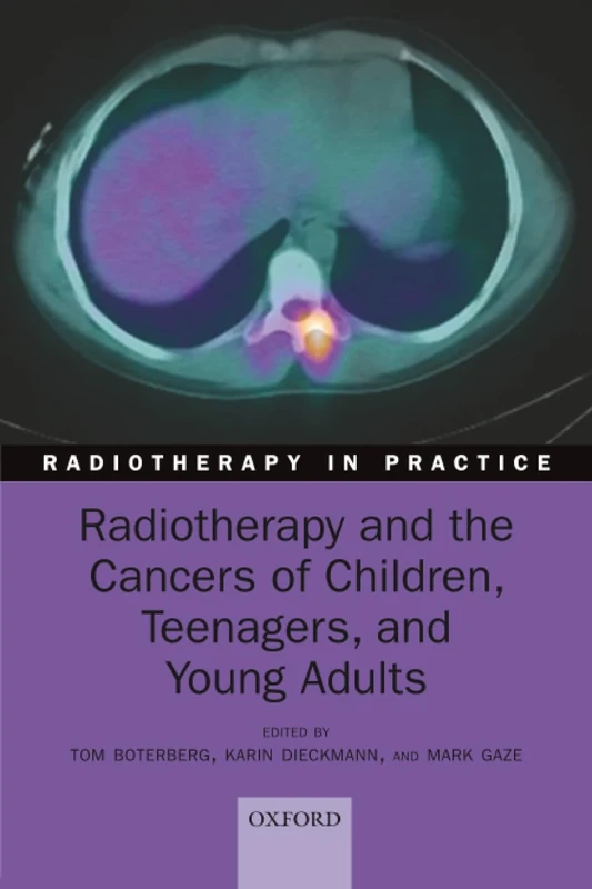RADIOTHERAPY & CANCERS OF CHILDREN, TEENAGERS, & YOUNG ADULTS RADIP (Radiotherapy in Practice)