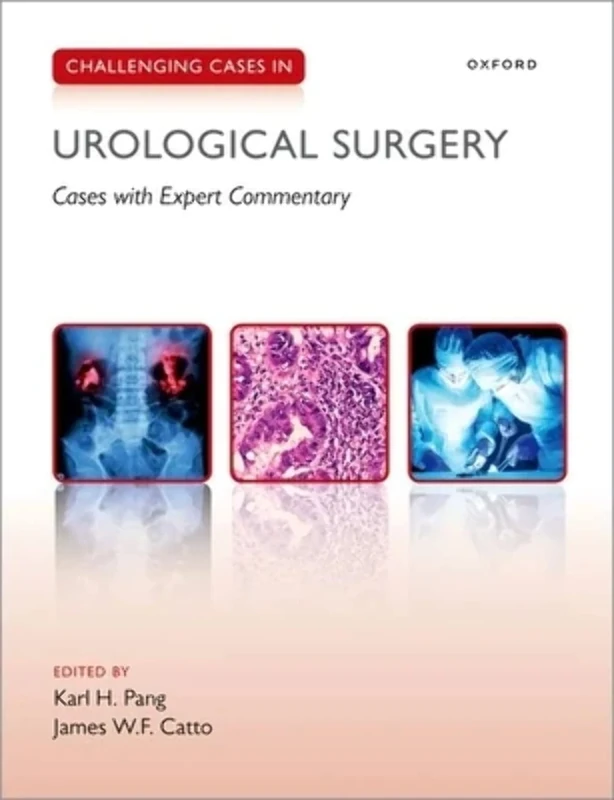 Challenging Cases in Urological Surgery: Cases With Expert Commentary