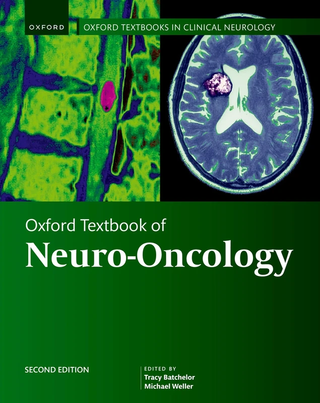 Oxford Textbook of Neuro-Oncology (Oxford Textbooks in Clinical Neurology)