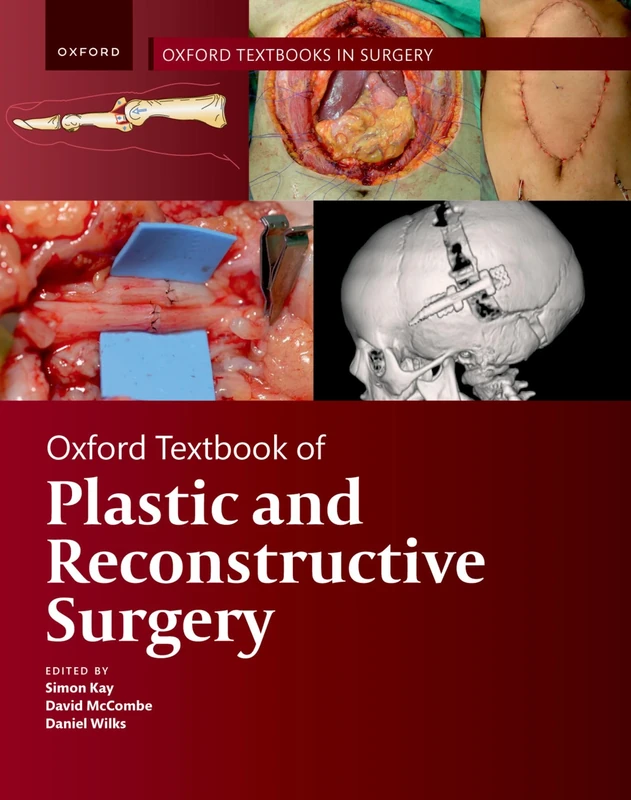 Oxford Textbook of Plastic and Reconstructive Surgery (Oxford Textbooks in Surgery)