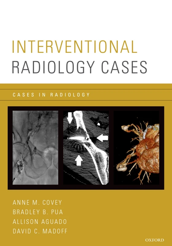 Interventional Radiology Cases (Cases In Radiology)