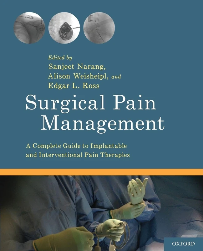 Oxford University Press - Surgical Pain Management Guide