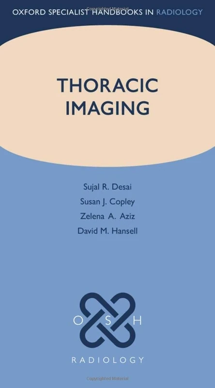 Thoracic Imaging (Oxford Specialist Handbooks in Radiology)