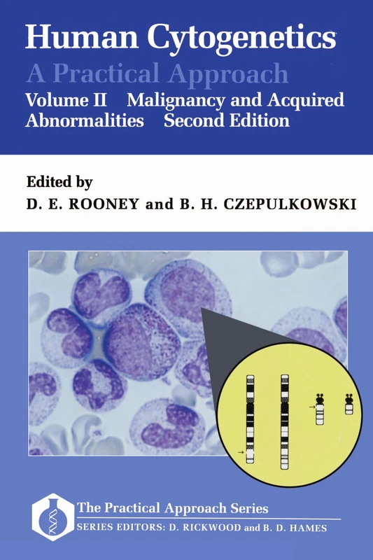 Human Cytogenetics: A Practical Approach Volume II: Malignancy and Acquired Abnormalities: 97 (Practical Approach Series)