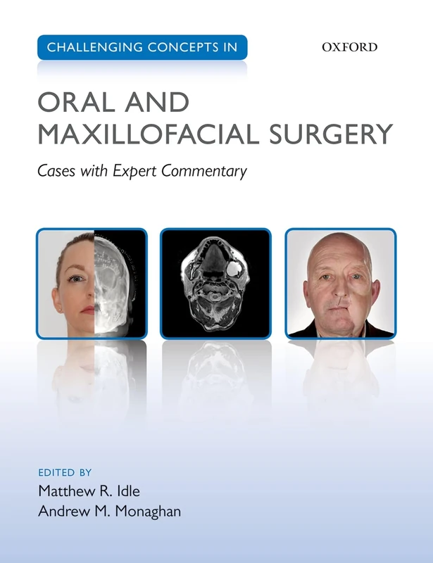 Challenging Concepts in Oral and Maxillofacial Surgery: Cases with Expert Commentary (Challenging Cases)