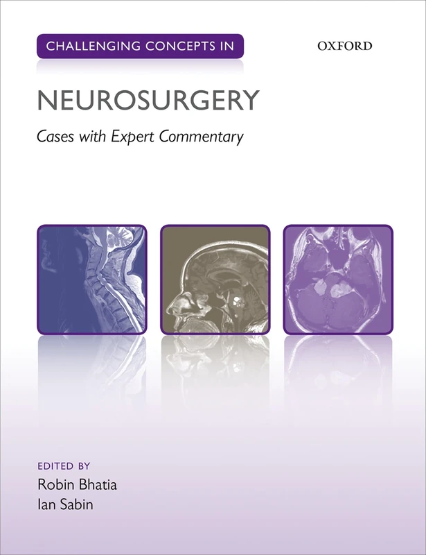 Challenging Concepts in Neurosurgery: Cases with Expert Commentay (Challenging Cases)