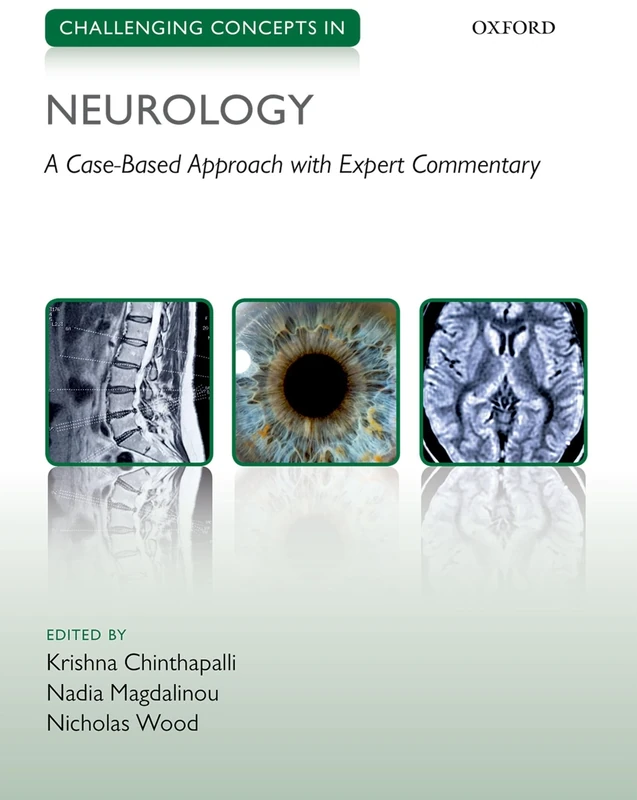 Challenging Concepts in Neurology: Cases with Expert Commentary (Challenging Cases)