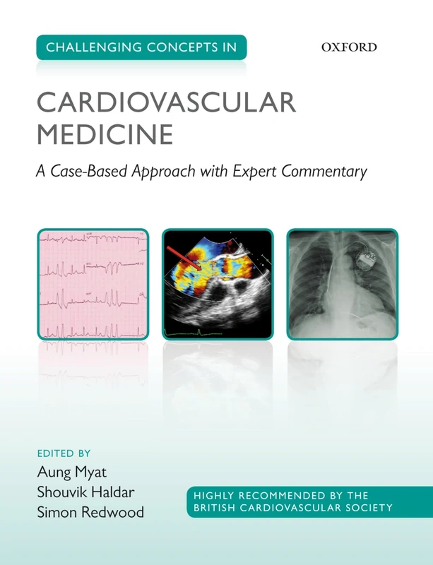 Challenging Concepts in Cardiovascular Medicine: Cases with Expert Commentary: A Case-Based Approach with Expert Commentary (Challenging Cases)