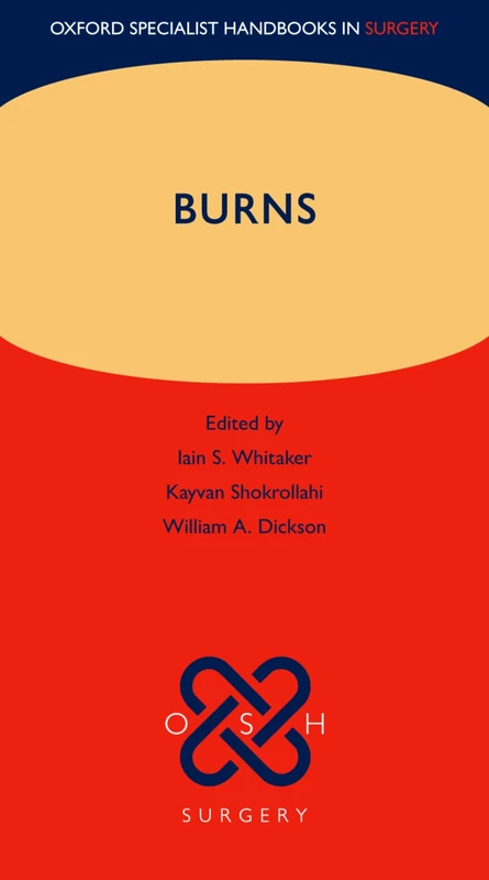 Burns (Oxford Specialist Handbooks in Surgery)
