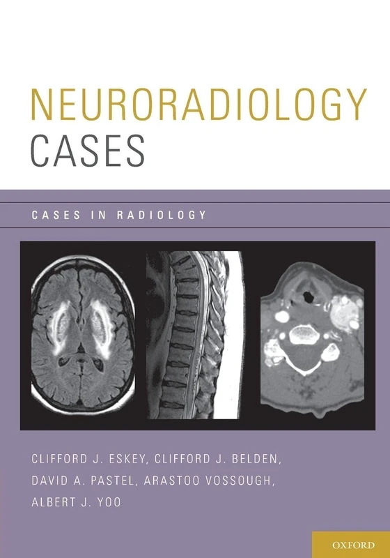 Neuroradiology Cases (Cases in Radiology)