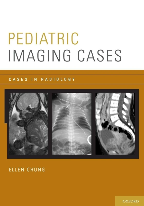 Pediatric Imaging Cases (Cases in Radiology)