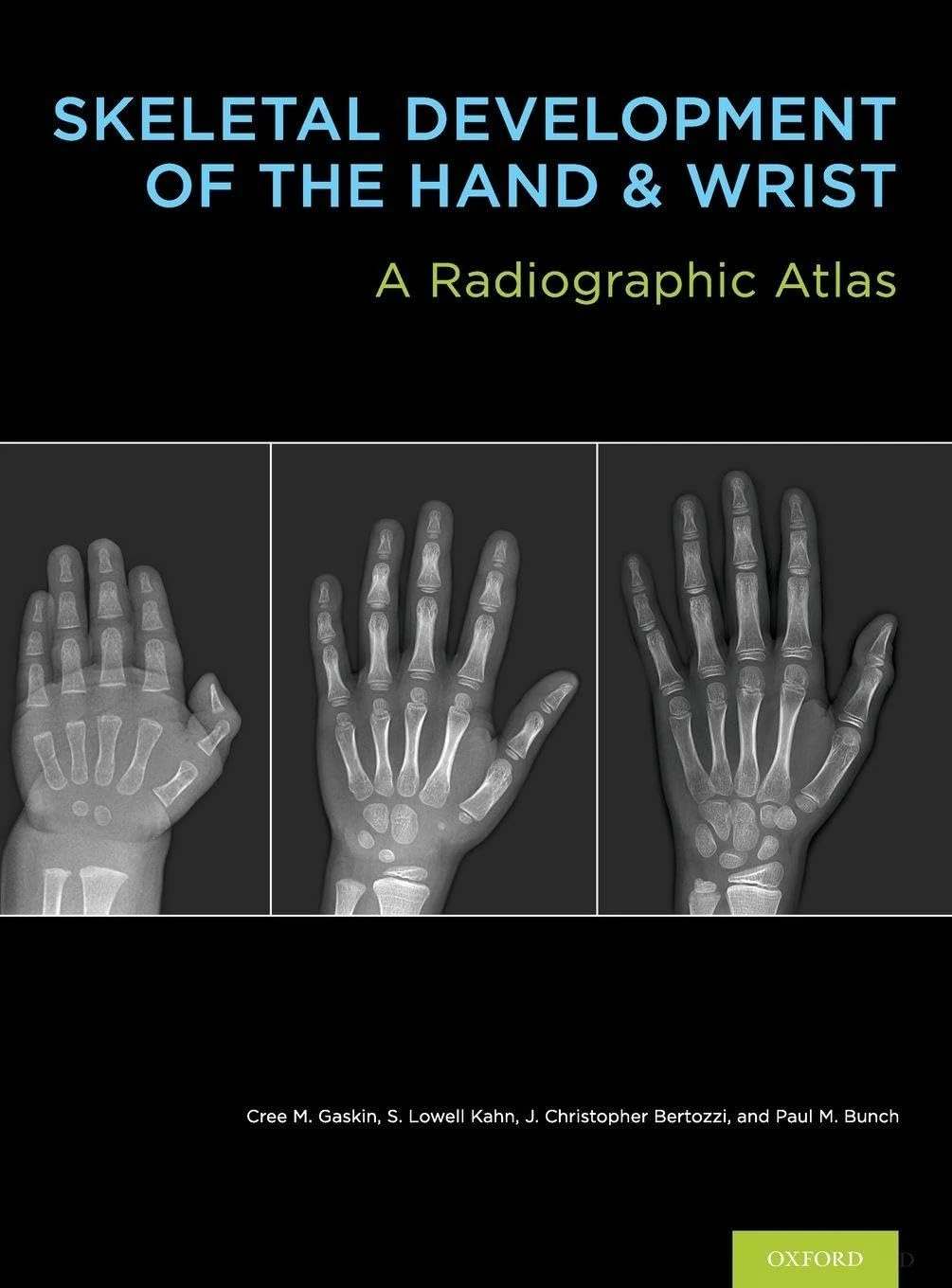 Skeletal Development of the Hand and Wrist: A Radiographic Atlas and Digital Bone Age Companion