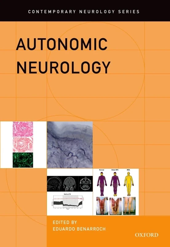Autonomic Neurology: 86 (Contemporary Neurology Series)