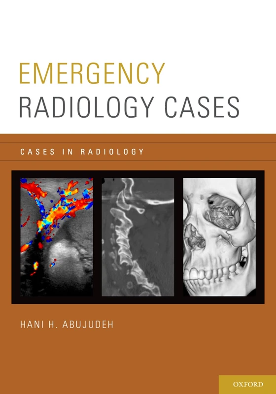 Emergency Radiology Cases (Cases in Radiology)