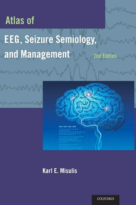 Atlas of EEG, Seizure Semiology, and Management