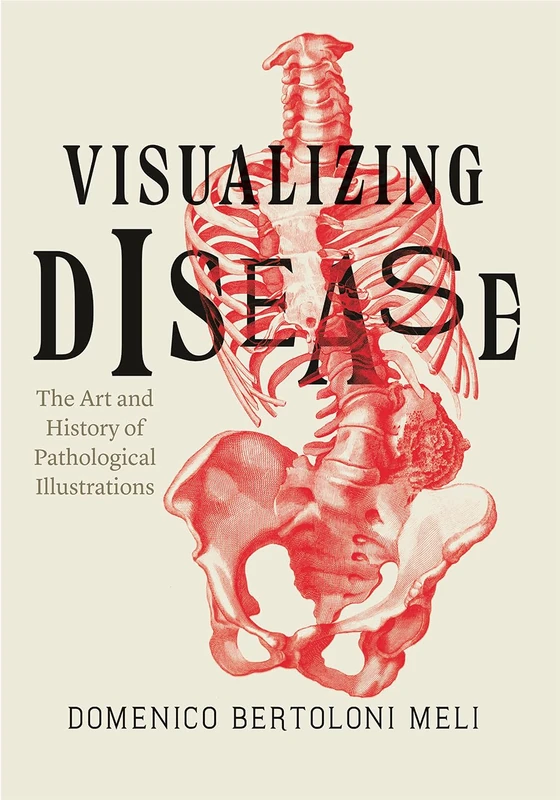 Visualizing Disease – The Art and History of Pathological Illustrations