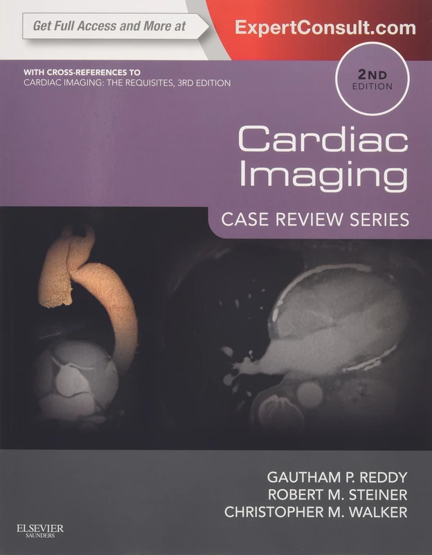Cardiac Imaging: Case Review Series: Case Review Series