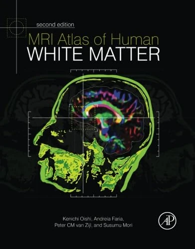 MRI Atlas of Human White Matter