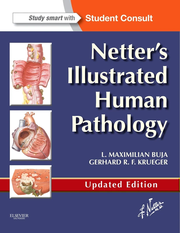 Netter's Illustrated Human Pathology Updated Edition: with Student Consult Access (Netter Basic Science)