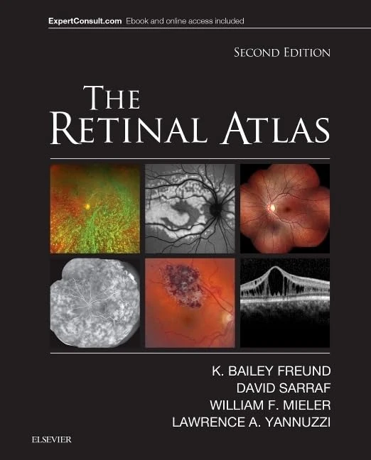 The Retinal Atlas: Expert Consult - Online and Print