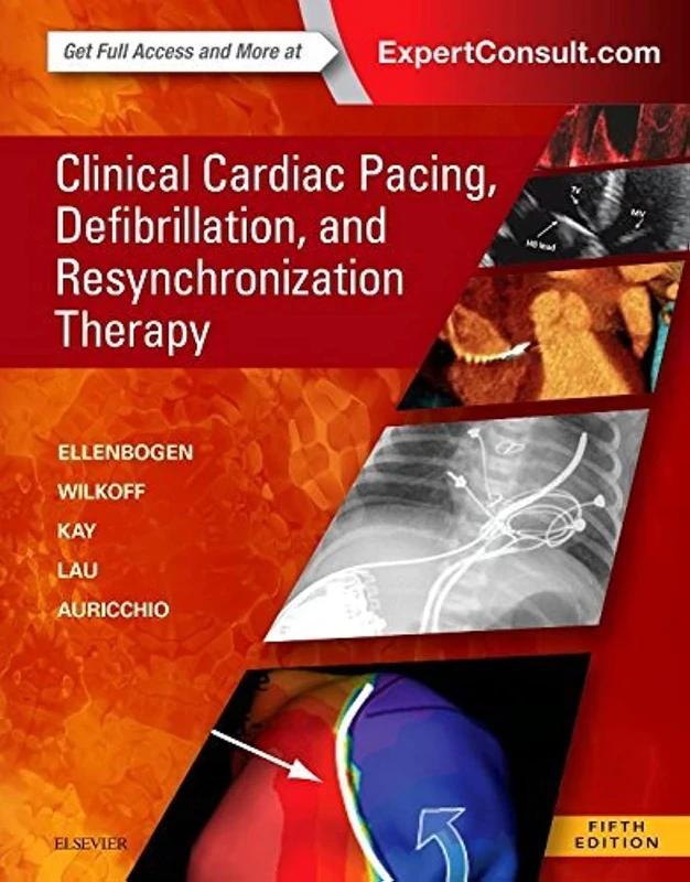Clinical Cardiac Pacing, Defibrillation and Resynchronization Therapy: Expert Consult Premium Edition - Enhanced Online Features and Print