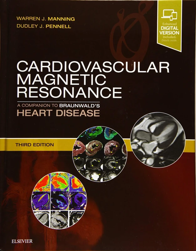 Cardiovascular Magnetic Resonance: A Companion to Braunwald's Heart Disease