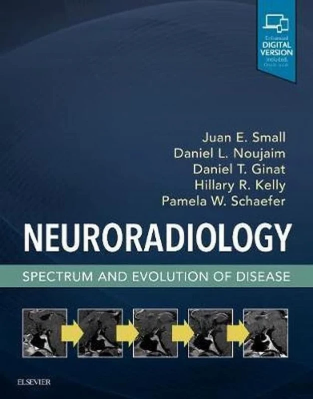 Neuroradiology: Spectrum and Evolution of Disease: Spectrum and Evolution of Disease
