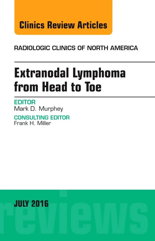Extranodal Lymphoma from Head to Toe, An Issue of Radiologic Clinics of North America (Volume 54-4) (The Clinics: Radiology, Volume 54-4)