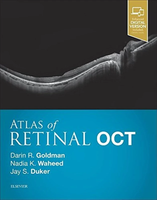 Atlas of Retinal OCT: Optical Coherence Tomography