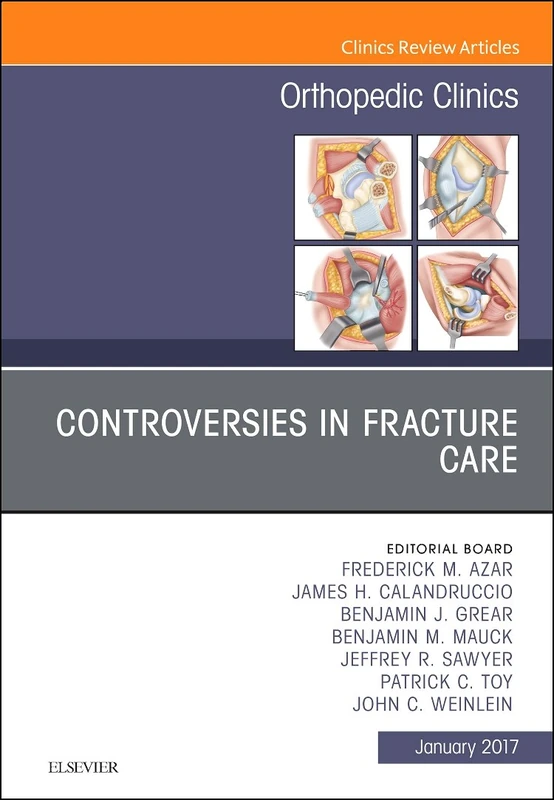 Controversies in Fracture Care, An Issue of Orthopedic Clinics (Volume 48-1) (The Clinics: Orthopedics, Volume 48-1)