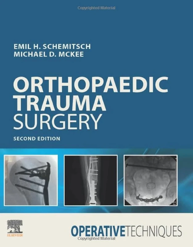 Operative Techniques: Orthopaedic Trauma Surgery