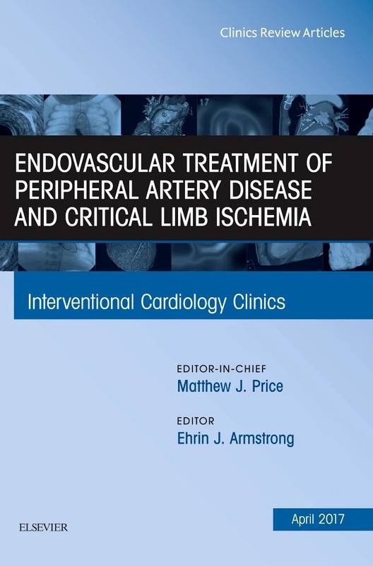 Endovascular Treatment of Peripheral Artery Disease and Critical Limb Ischemia, An Issue of Interventional Cardiology Clinics (Volume 6-2) (The Clinics: Internal Medicine, Volume 6-2)
