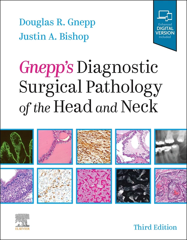 Gnepp's Diagnostic Surgical Pathology of the Head and Neck: Expert Consult - Online and Print