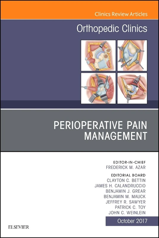 Perioperative Pain Management, An Issue of Orthopedic Clinics (Volume 48-4) (The Clinics: Orthopedics, Volume 48-4)