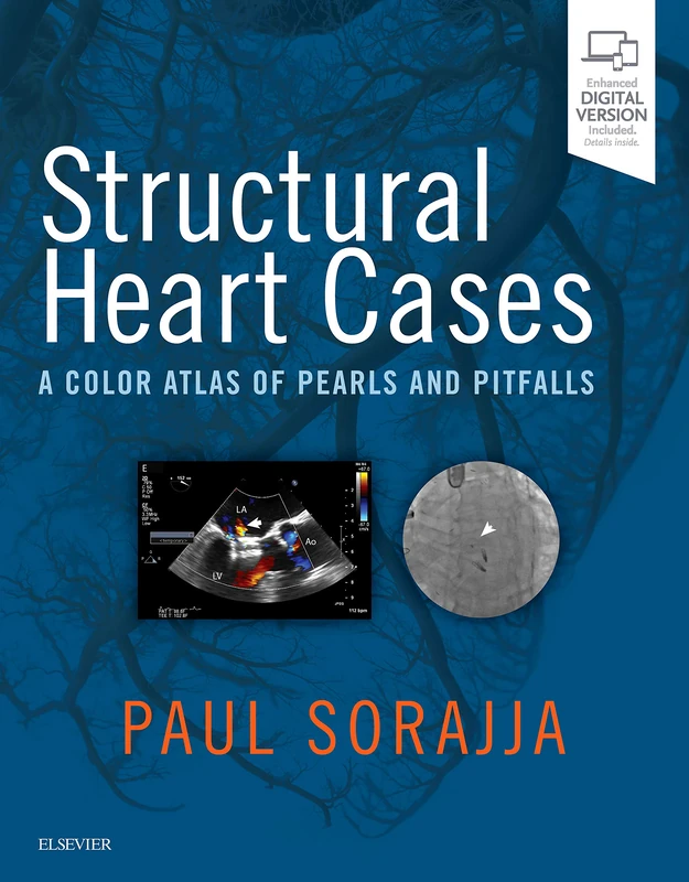 Structural Heart Cases: A Color Atlas of Pearls and Pitfalls - Image 1