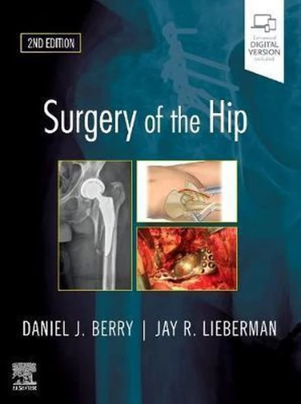 Surgery of the Hip: Expert Consult - Online and Print
