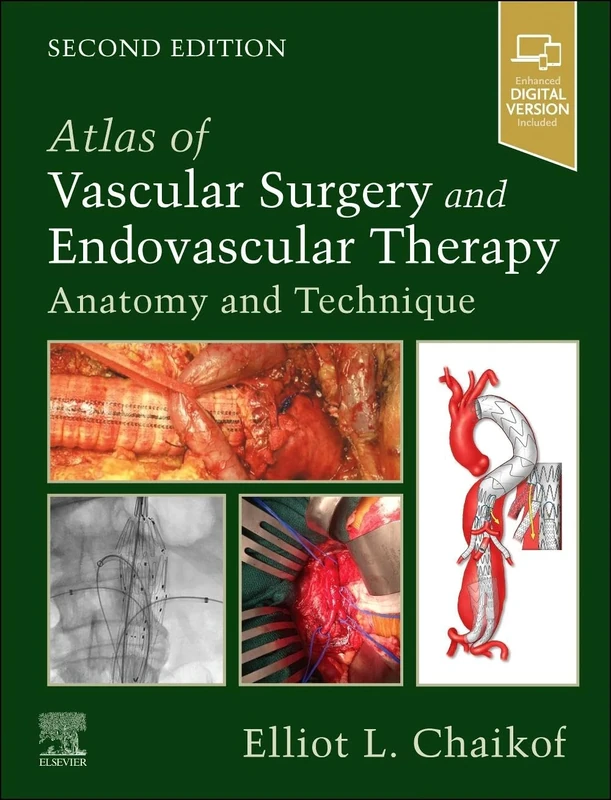 Atlas of Vascular Surgery and Endovascular Therapy: Anatomy and Technique