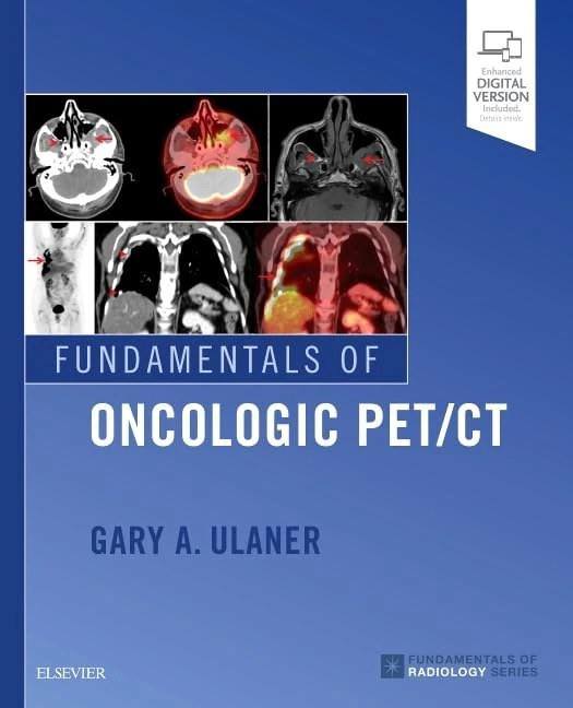 Fundamentals of Oncologic PET/CT (Fundamentals of Radiology)