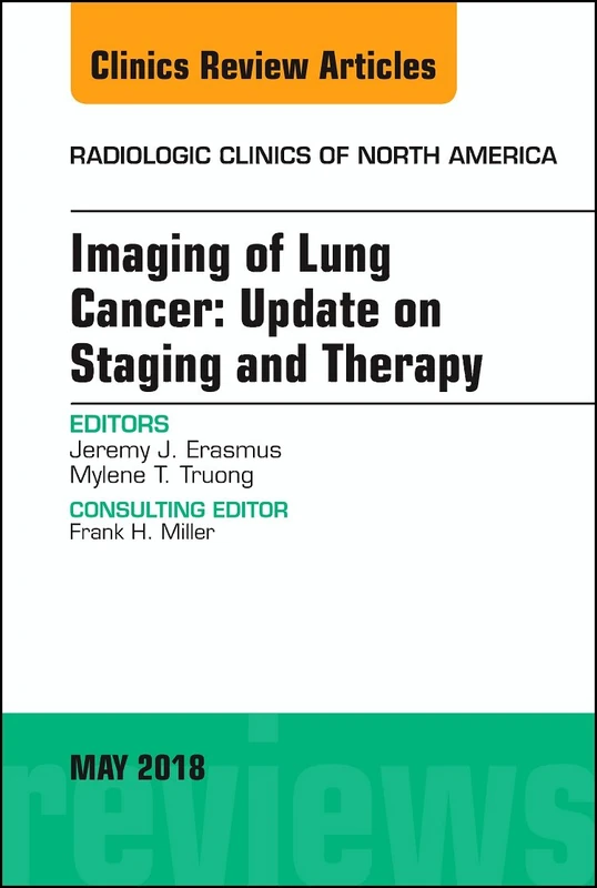 Lung Cancer, An Issue of Radiologic Clinics of North America (Volume 56-3) (The Clinics: Radiology, Volume 56-3)