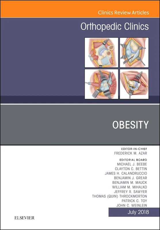 Obesity, An Issue of Orthopedic Clinics (Volume 49-3) (The Clinics: Orthopedics, Volume 49-3)