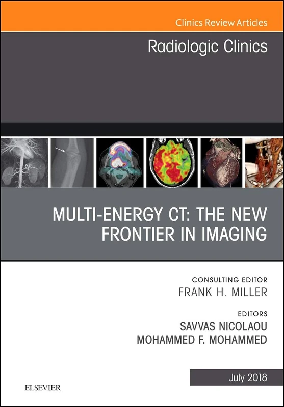 Multi-Energy CT: The New Frontier in Imaging, An Issue of Radiologic Clinics of North America (Volume 56-4) (The Clinics: Radiology, Volume 56-4)