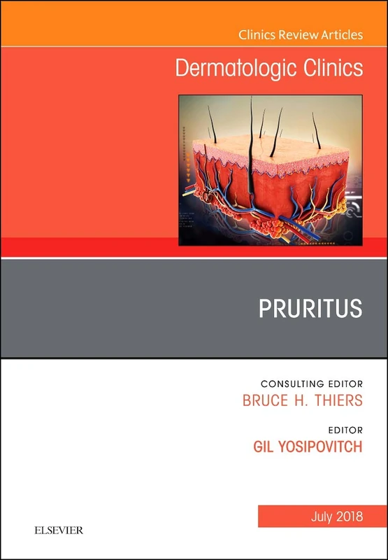 Pruritus, An Issue of Dermatologic Clinics (Volume 36-3) (The Clinics: Dermatology, Volume 36-3)