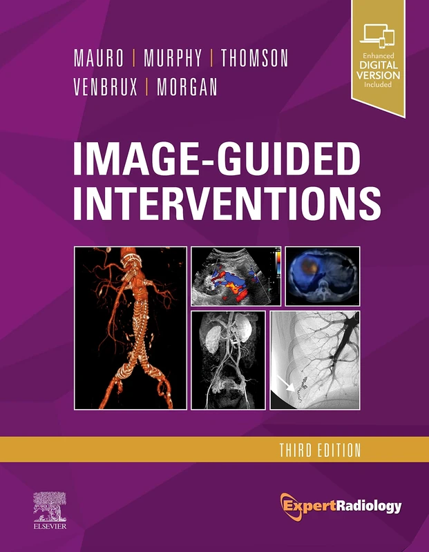 Image-Guided Interventions: Expert Radiology Series