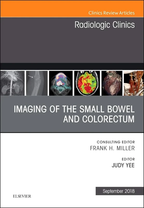 Imaging of the Small Bowel and Colorectum, An Issue of Radiologic Clinics of North America (Volume 56-5) (The Clinics: Radiology, Volume 56-5)