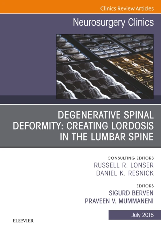 Degenerative Spinal Deformity: Creating Lordosis in the Lumbar Spine, An Issue of Neurosurgery Clinics of North America: Volume 29-3 (The Clinics: Surgery, Volume 29-3)