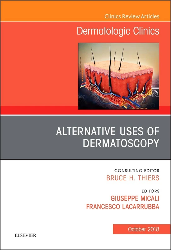 Alternative Uses of Dermatoscopy, An Issue of Dermatologic Clinics (Volume 36-4) (The Clinics: Dermatology, Volume 36-4) - Image 1