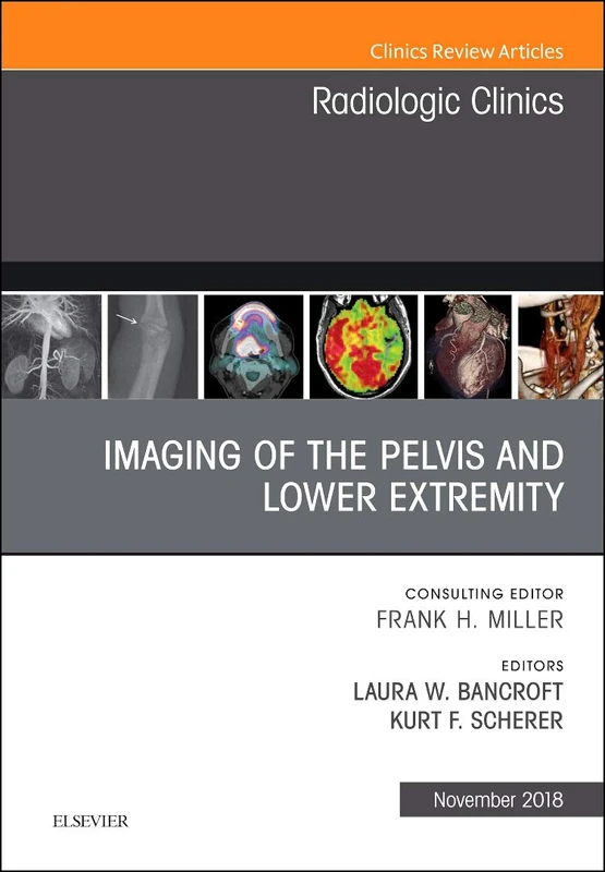 Imaging of the Pelvis and Lower Extremity, An Issue of Radiologic Clinics of North America (Volume 56-6) (The Clinics: Radiology, Volume 56-6)